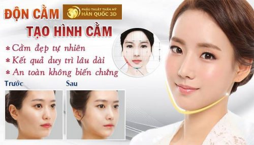 Độn cằm v line